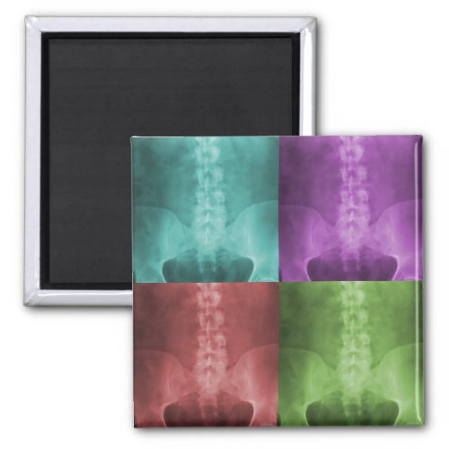 Digital X_Ray Art Magnet