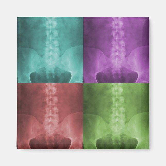 Digital X-Ray Art Magnet (Front)
