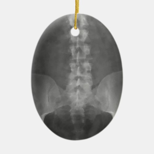 Digital X-Ray Art Ornament