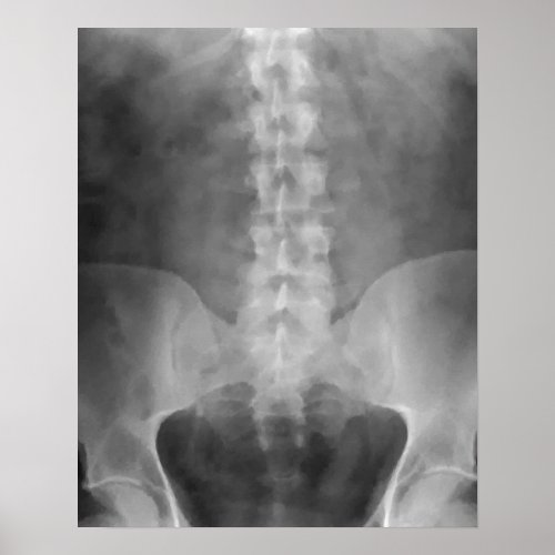 Digital X-Ray Art Print