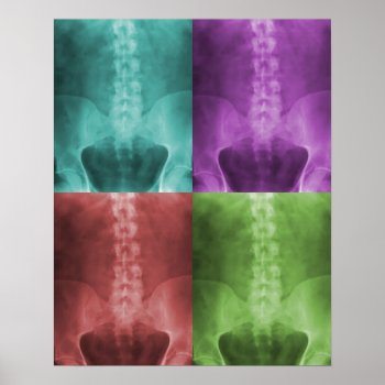 Digital X-ray Art Print by chiropracticbydesign at Zazzle