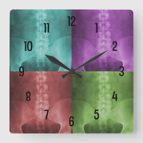 Digital X-Ray Art Wall Clock