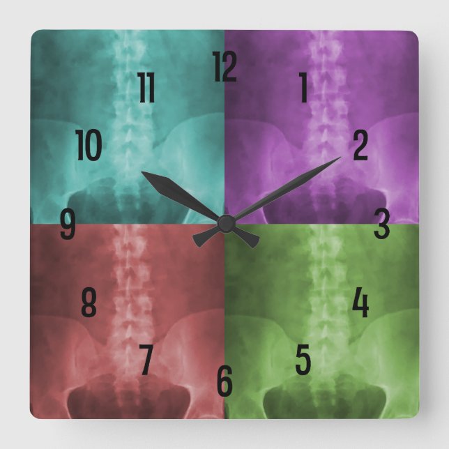 Digital X-Ray Art Wall Clock (Front)