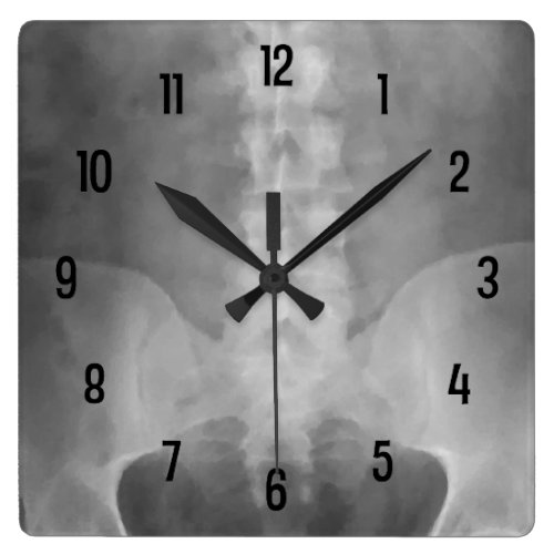 Digital X-Ray Art Wall Clock