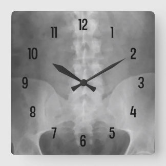 Digital X-Ray Art Wall Clock