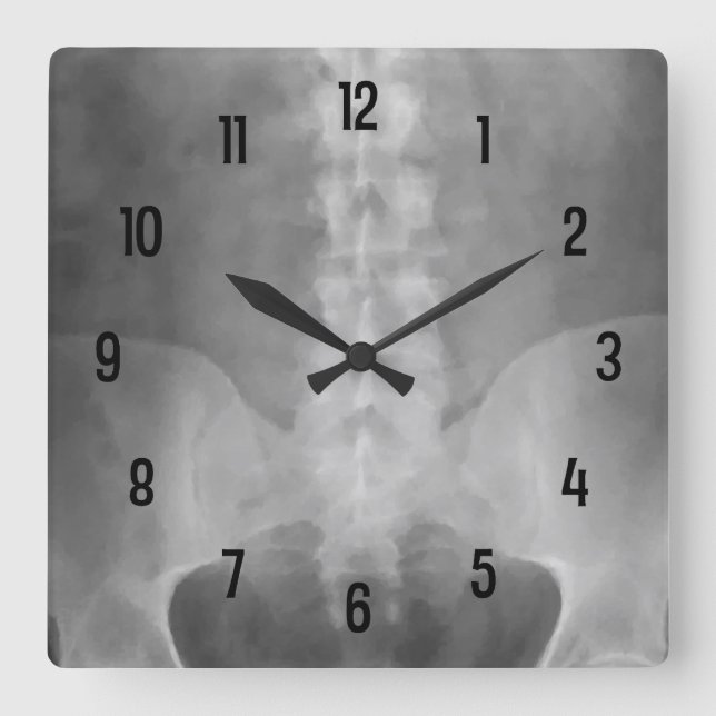 Digital X-Ray Art Wall Clock (Front)