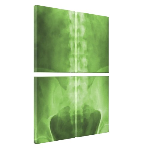 Digital X-Ray Art Wrapped Canvas