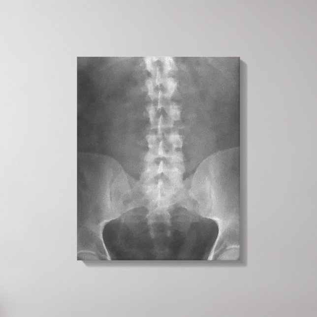 Digital X-Ray Art Wrapped Canvas Print (Front)