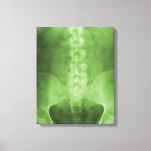 Digital X-Ray Art Wrapped Canvas Print