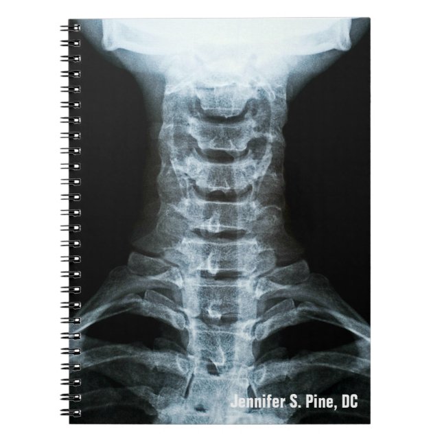 Digital X-Ray Personalized Notebook (Front)