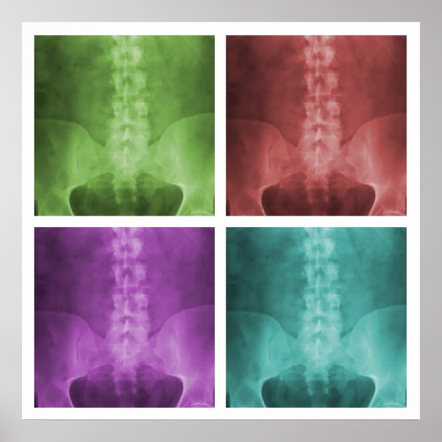 Digital X-Ray Pop Art Square Poster (Front)