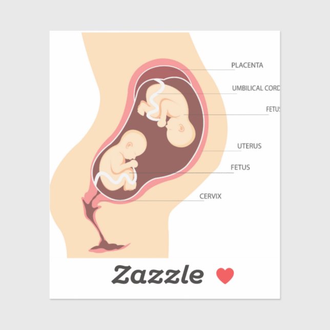 Dizygotic twin pregnancy sticker (Sheet)