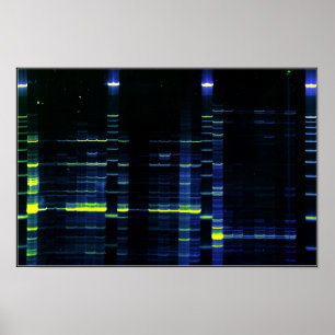 DNA Sequence gel 1 Poster