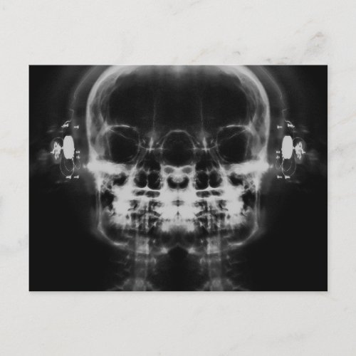 Double X_Ray Skulls with Headphones _ BW Postcard