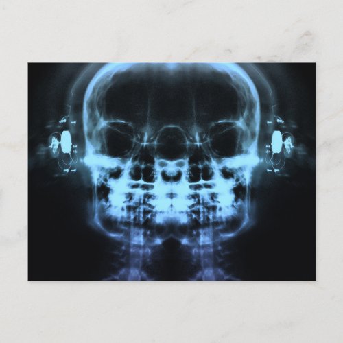 Double X_Ray Skulls with Headphones _ Blue Postcard