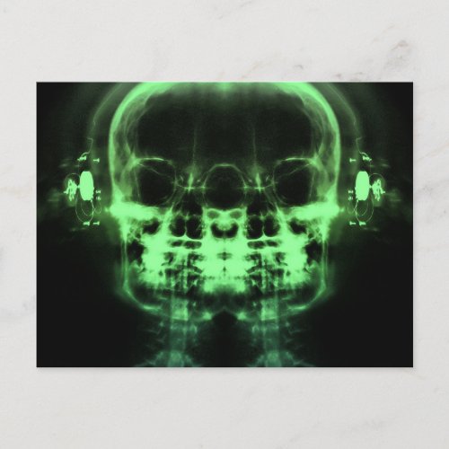 Double X_Ray Skulls with Headphones _ Green Postcard