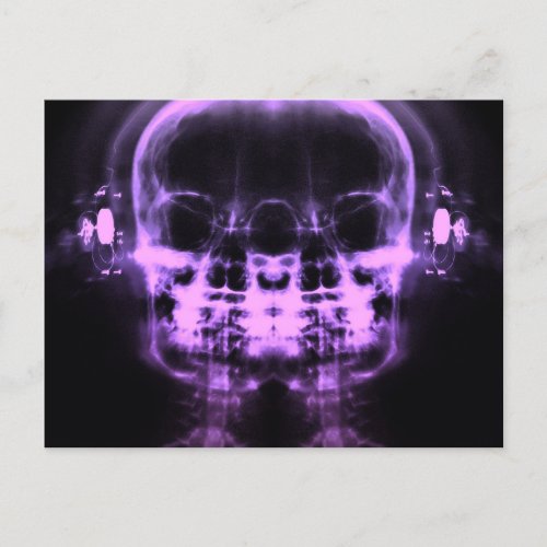 Double X_Ray Skulls with Headphones _ Purple Postcard