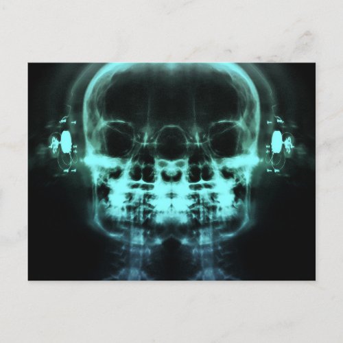 Double X_Ray Skulls with Headphones _ Teal Postcard