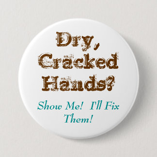 Dry,CrackedHands?, Show Me! I'll Fix Them! Pinback Button