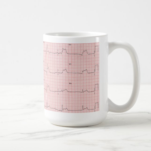 ECG mug (Right)