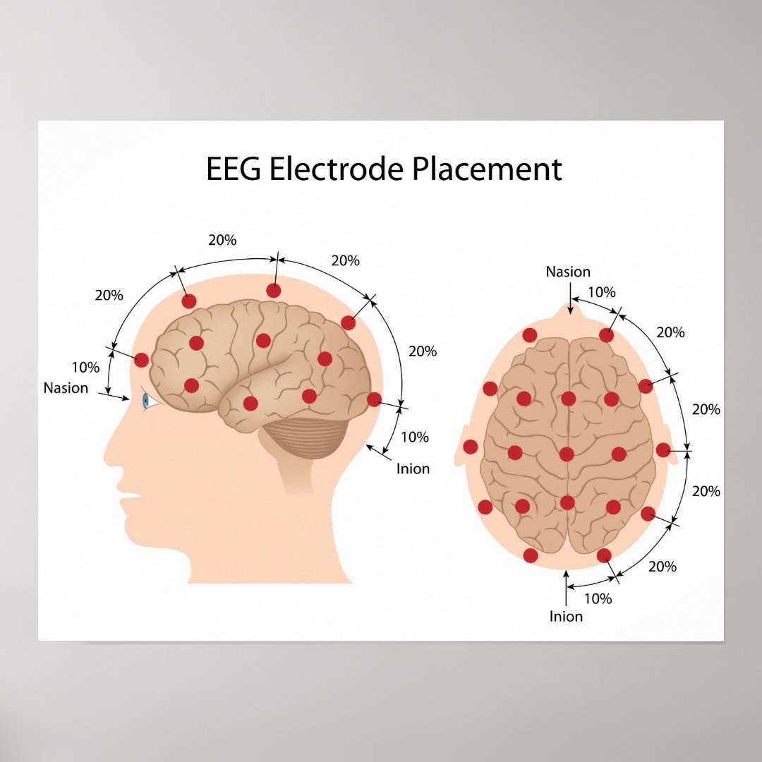 EEG electrode placement diagram Poster | Zazzle