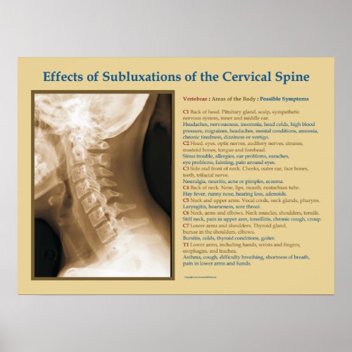 Effects of Cervical Spinal Subluxation Poster