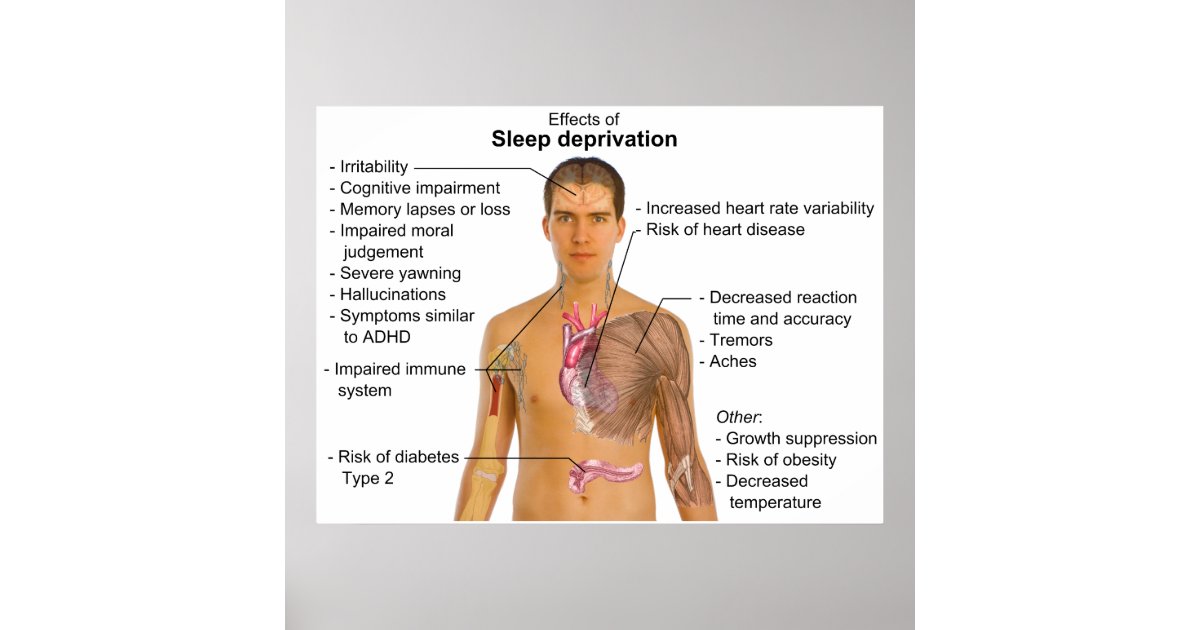 Sleep deprivation hallucinations