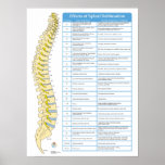 Effects Of Spinal Subluxation Chiropractic Poster at Zazzle