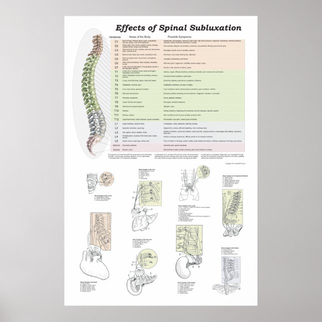 Effects of Spinal Subluxation Poster Chiropractic (Front)