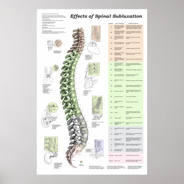 Effects of Spinal Subluxation Poster Chiropractic (Front)