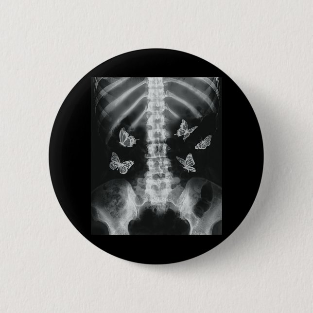 Egirl Skeleton Xray Butterfly Harajuku y2k Dark Ed Button (Front)