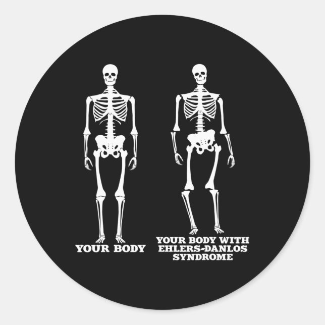 Ehlers-Danlos Syndrome Awareness  Classic Round Sticker (Front)