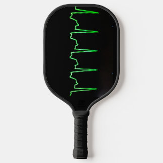 EKG and echocardiogram pickleball paddle