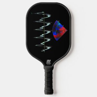EKG and echocardiogram pickleball paddle