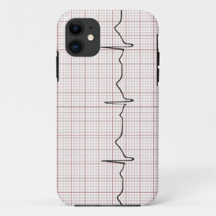 EKG heartbeat on graph paper, PhD (doctor) pulse iPhone 11 Case