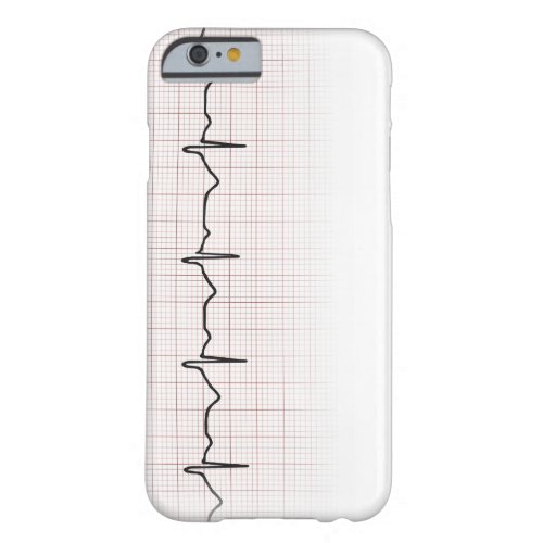 EKG heartbeat on graph paper PhD doctor pulse Barely There iPhone 6 Case