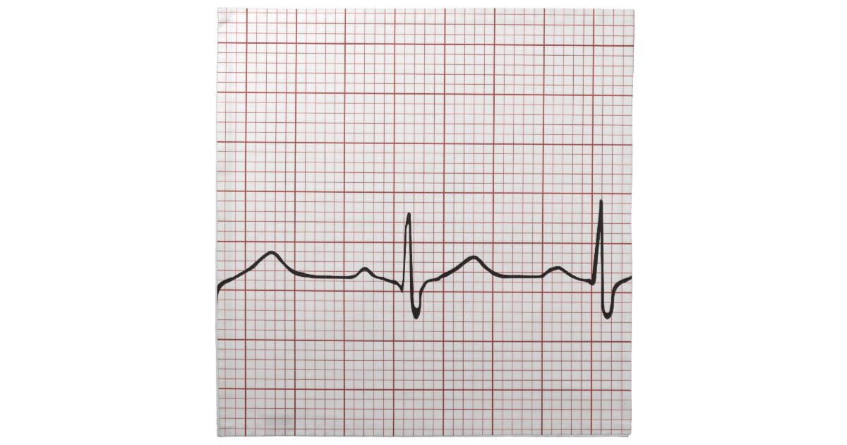 ekg heartbeat on graph paper phd doctor pulse cloth when looking at ecg graph paper one large box represents