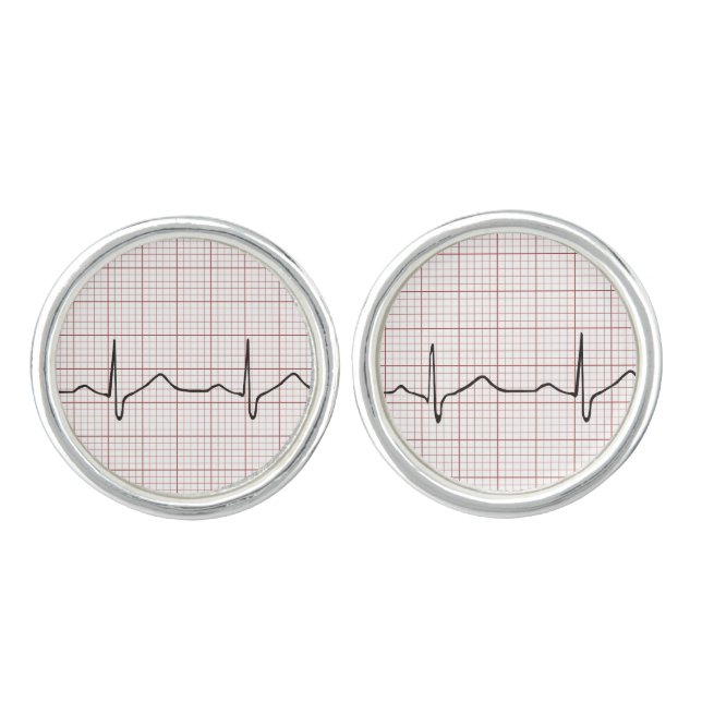 EKG heartbeat on graph paper, PhD (doctor) pulse Cufflinks (Front)