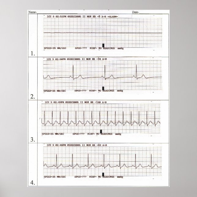 ekg Rhythms Poster (Front)