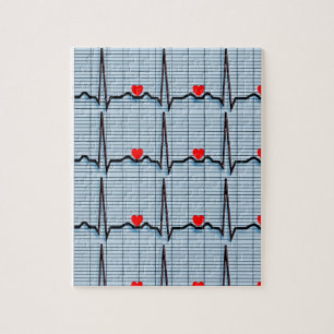 EKG Strips Jigsaw Puzzle