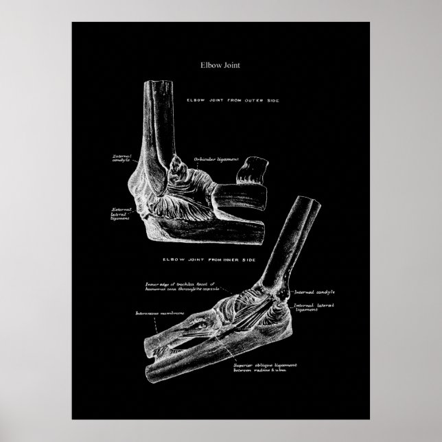 Elbow Joint Anatomy Orthopedic Wall Decor (Front)
