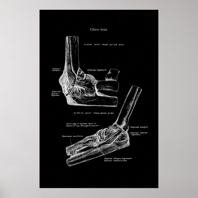 Elbow Joint Orthopedic Wall Decor (Front)