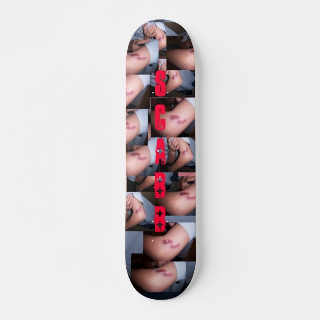 Elbow SCABB Skateboard Deck (Front)