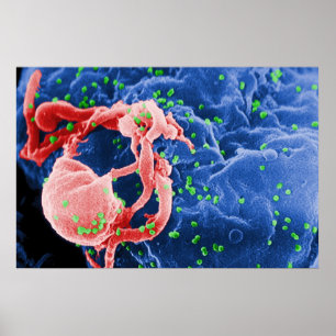 Electron Micrograph of HIV-1 Budding Lymphocyte Poster