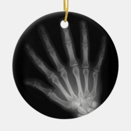 Extra Digit X_ray Left Hand Ceramic Ornament