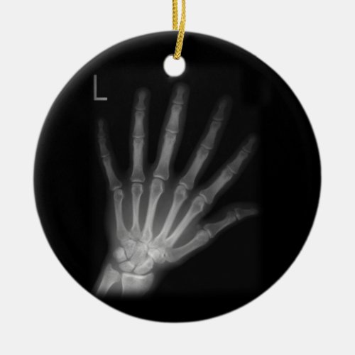 Extra Digit X_ray Left Hand Ceramic Ornament
