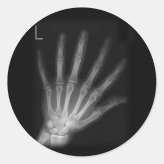 Extra Digit X-ray Left Hand Classic Round Sticker