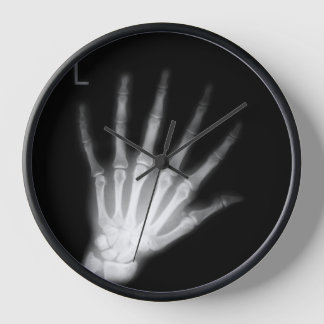 Extra Digit X-ray Left Hand Clock