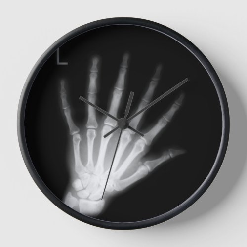Extra Digit X_ray Left Hand Clock