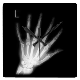 Extra Digit X-ray Left Hand Square Wall Clock